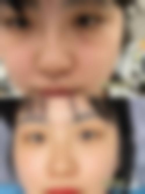 二、张家界依莱美医疗整形医院怎么样？