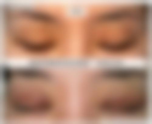 三、张家界依莱美医疗整形医院诊疗项目有哪些？