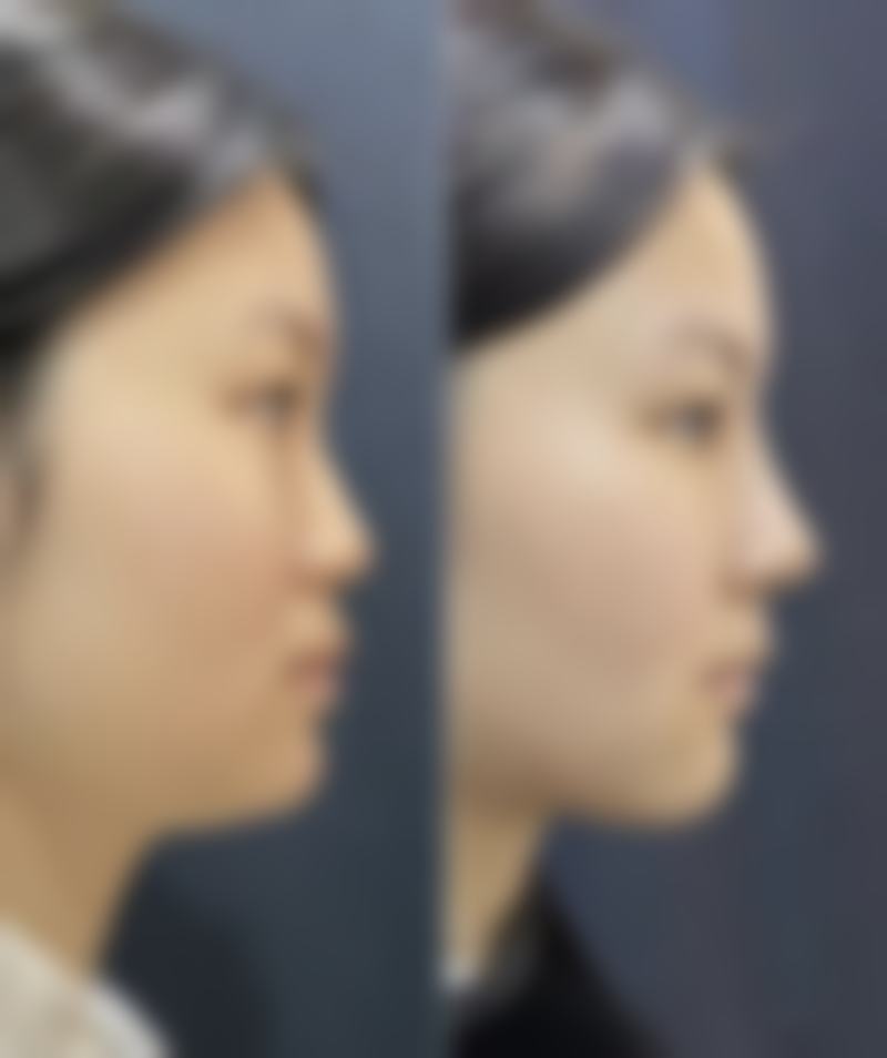 六、术后护理要点