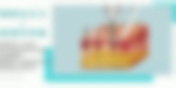 荆州华美植发美容中心