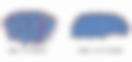 六、路标真实的患者评价