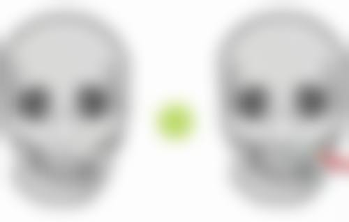 内双适合割什么款式的双眼皮好看？综合因素考量助你选到理想眼型！ 