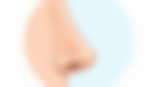 二、设计双眼皮需考虑的因素