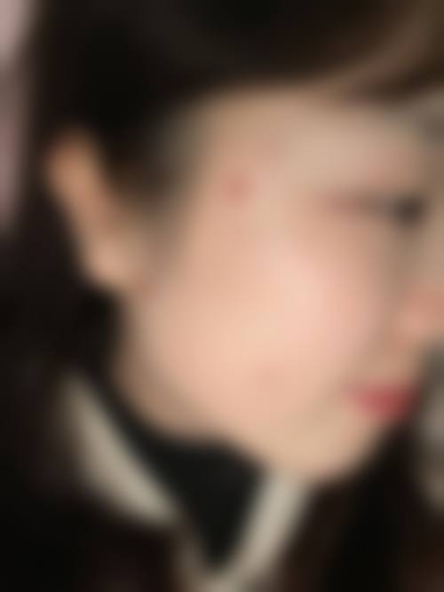 八、宁波江北徐建国医疗美容门诊部真实的患者评价