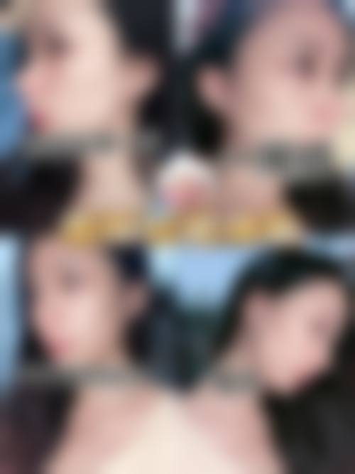 五、宁波江北徐建国医疗美容门诊部价格表