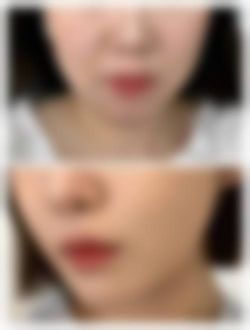 四、宁波江北徐建国医疗美容门诊部特色项目