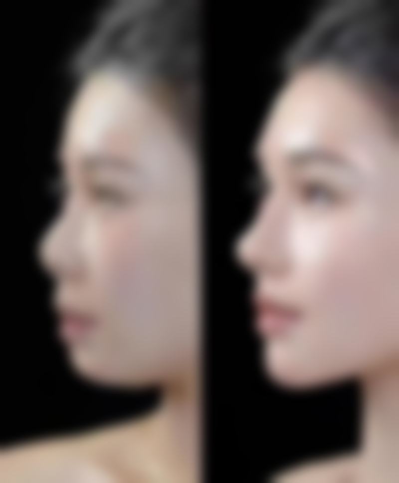 二、晋中德尔美客四维医疗美容诊所怎么样？