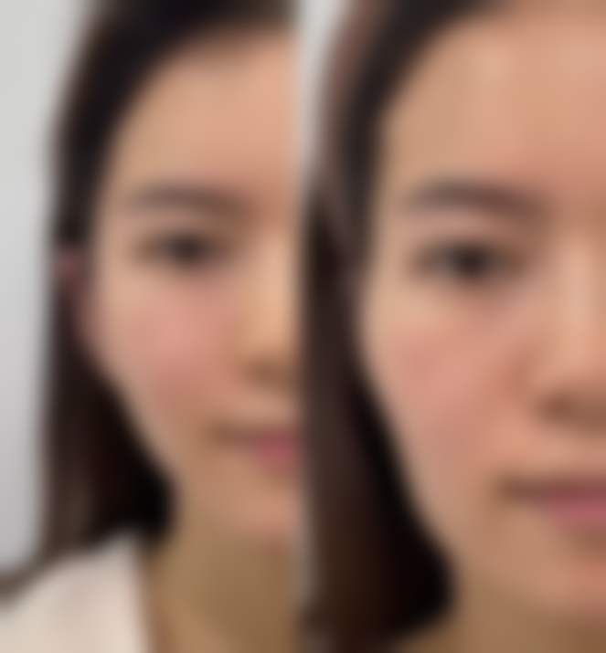 九、青岛元美整形美容门诊部真实的患者评价