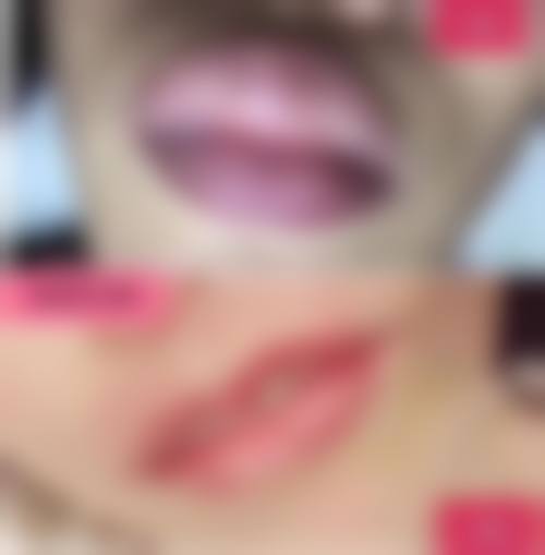 五、日常护理辅助去除鼻子上的小疤痕