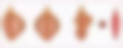 五、肚子吸脂皮会松吗?保持良好心态和生活习惯