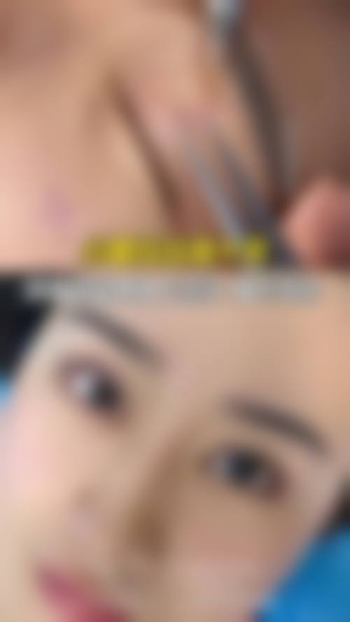 五、张少如怎么预约？