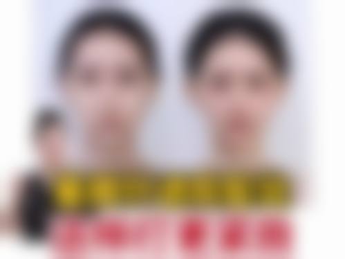 二、河北邯郸市京美整形怎么样?