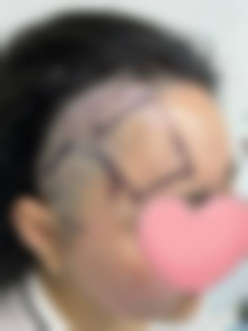 七、成都熙之医学美容门诊部预约方式