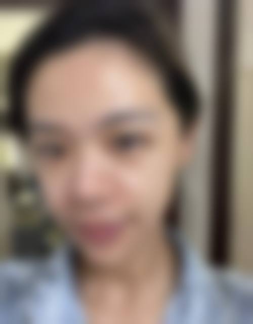 五、成都熙之医学美容门诊部价格表