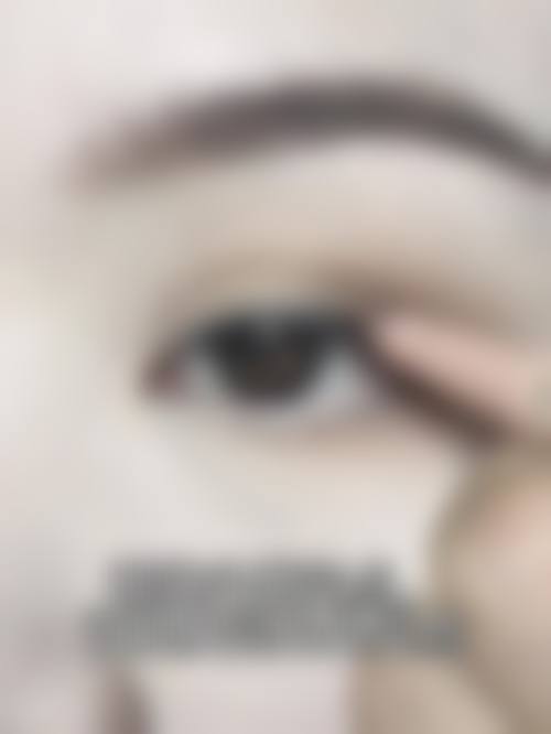 四、都江堰呈美（玛恩皮肤）医学美容诊所特色项目