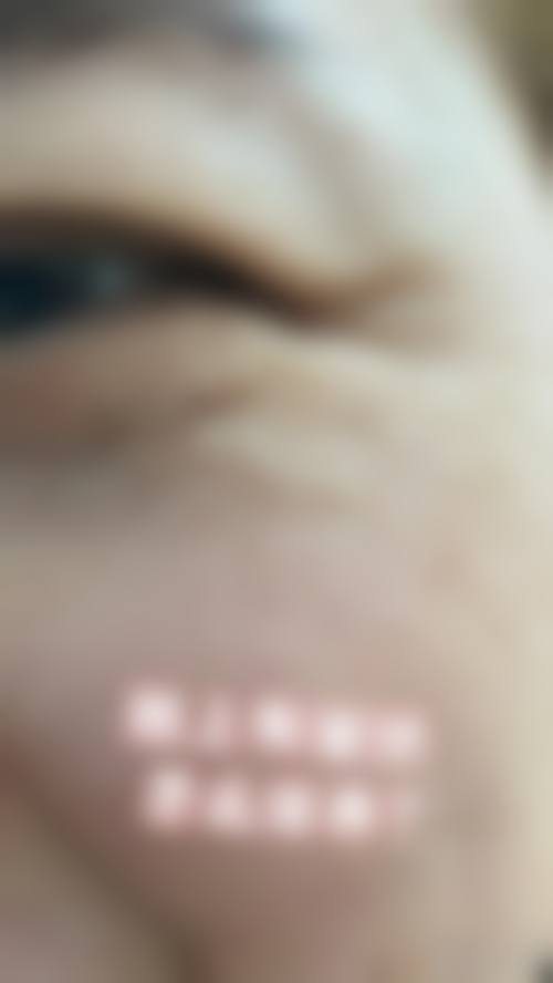 九、深圳星韵医疗美容门诊部真实的患者评价