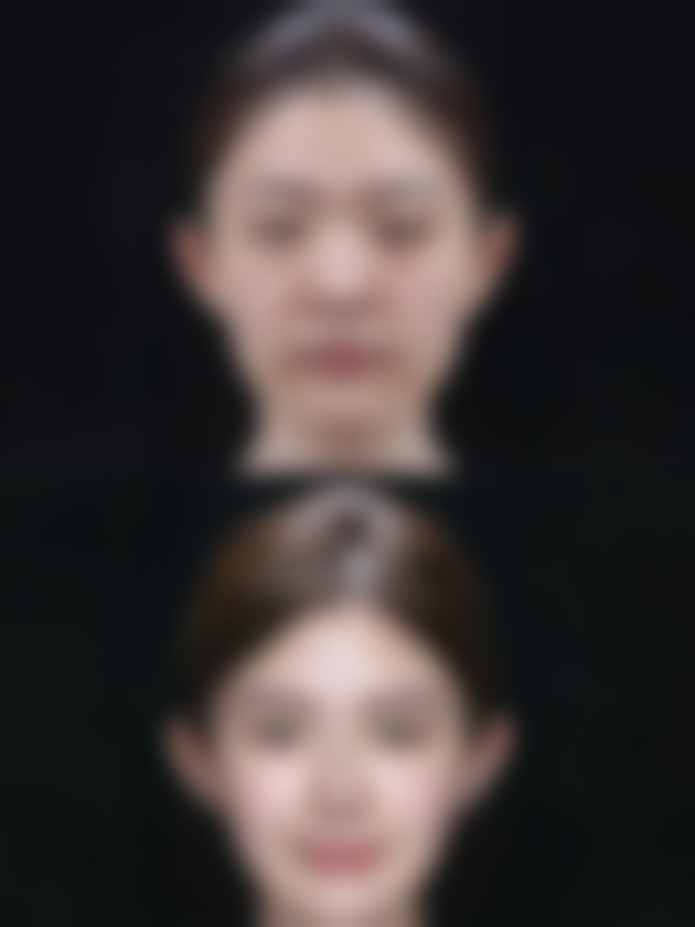 八、杭州迪美医疗美容预约方式