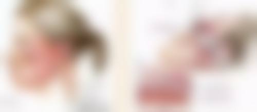 一、自然双眼皮消失的可能性