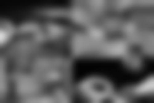 二、影响全切双眼皮维持时间的因素