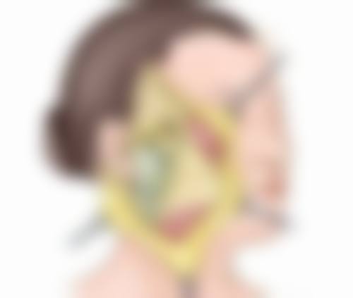 六、打完瘦脸针后的注意事项