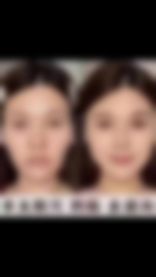 四、郑州欧华医疗美容诊所特色项目