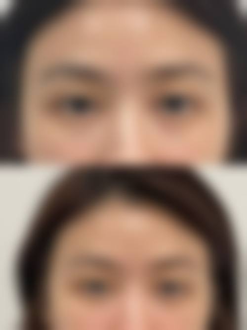 四、运城华美整形美容医院特色项目