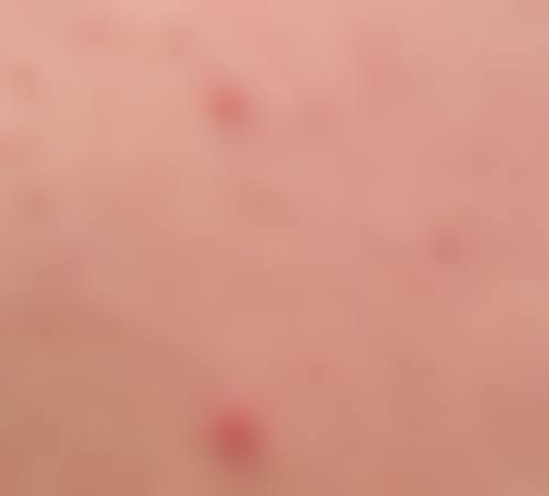 二、李菁园擅长项目