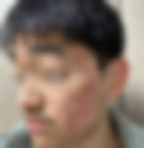 五、李菁园怎么预约？