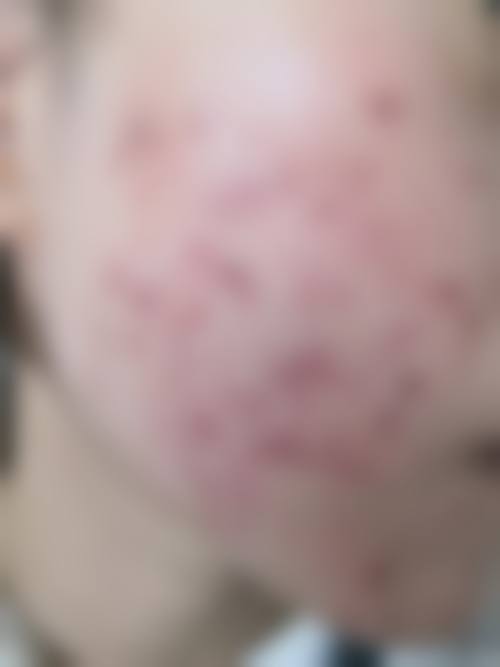 四、李菁园收费价格表