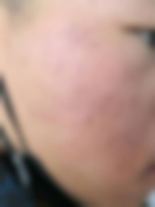 三、李菁园技术优势