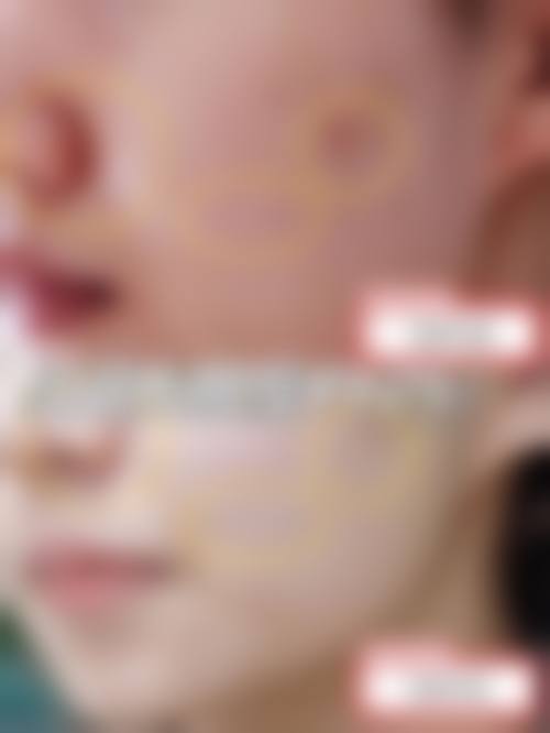 二、运城华美整形美容医院怎么样？