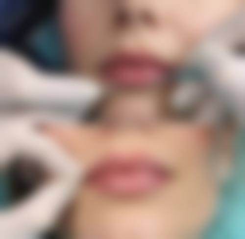 八、运城华美整形美容医院预约方式