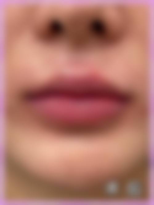 六、运城华美整形美容医院价格表