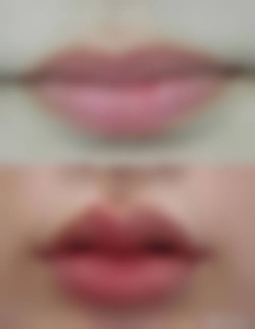 三、运城华美整形美容医院诊疗项目有哪些？