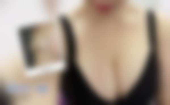 北京禾美嘉医疗美容门诊部任学会擅长哪些项目？涵盖隆胸吸脂等脂肪整形领域