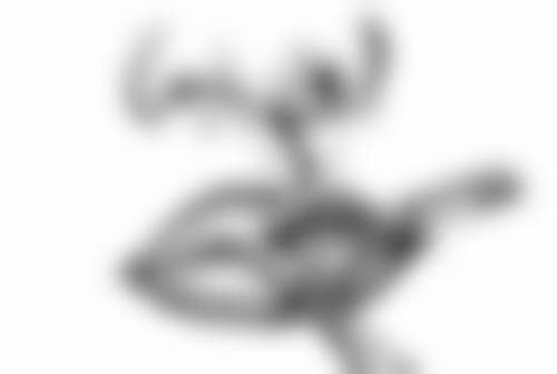 四、双眼皮提肌手术的术后调整