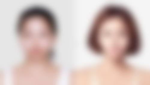 一、怎样消除眼袋泪沟之成因大揭秘