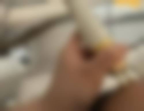 小型凹陷疤痕能修复吗？