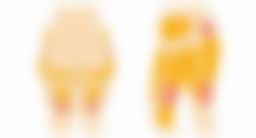 二、假体隆胸有一边硬的解决方案