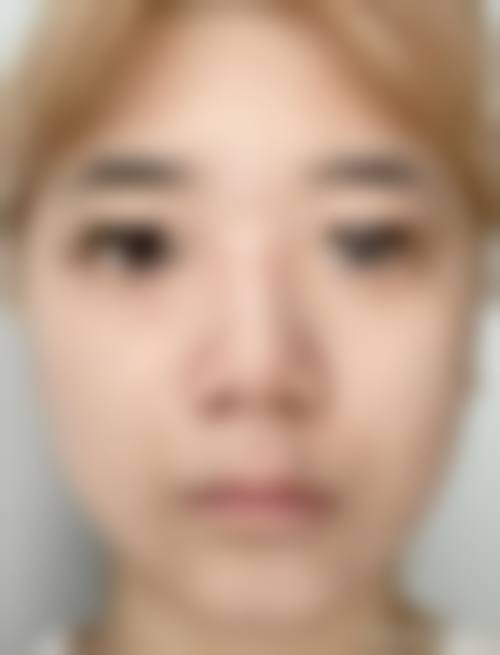 九、温州艺星整形美容医院真实的患者评价