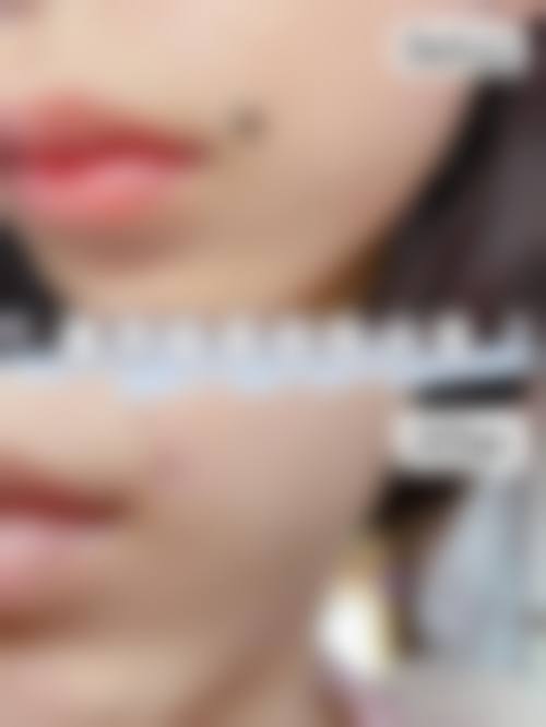 二、青岛媞妃整形医院怎么样？