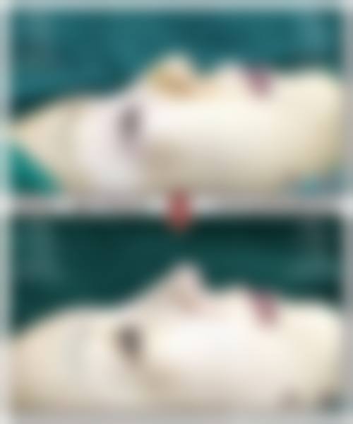 三、阜阳市第五人民医院整形美容科诊疗项目有哪些？