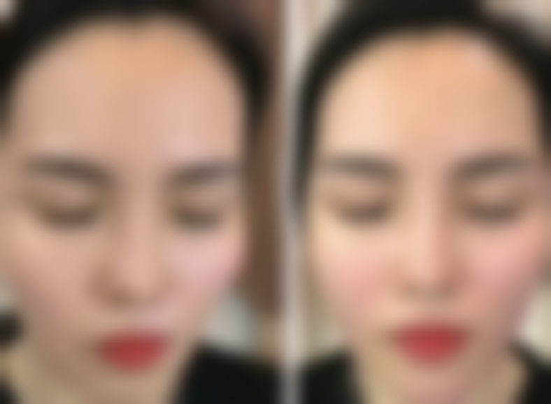 四、张靖晨收费价格表