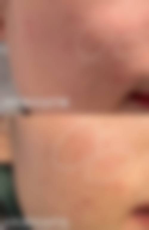 隆鼻一周可以化妆吗？解析隆鼻术后一周化妆风险与安全上妆时间建议