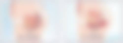 双眼皮用抹去疤膏吗？了解手术方式、体质与使用时机，揭秘祛疤膏是否有用 