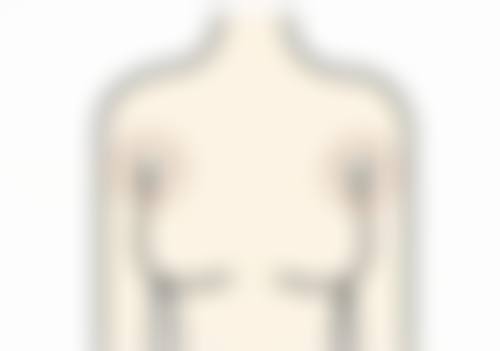 二、怎么去除烧伤后的疤痕之常见修复方案