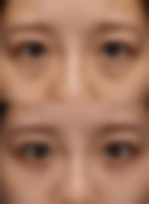 五、方荃怎么预约？