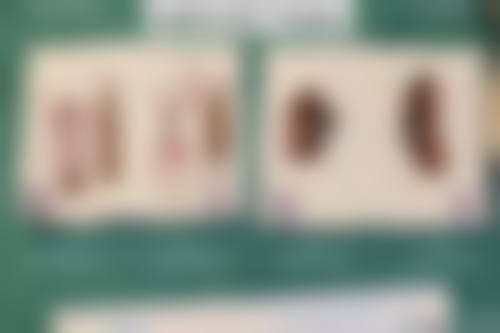 三、覃艳妮技术优势