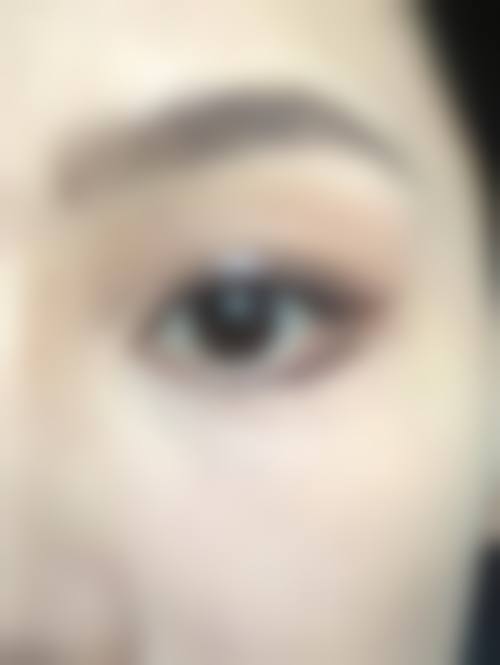 八、北京耐觅整形医院真实的患者评价