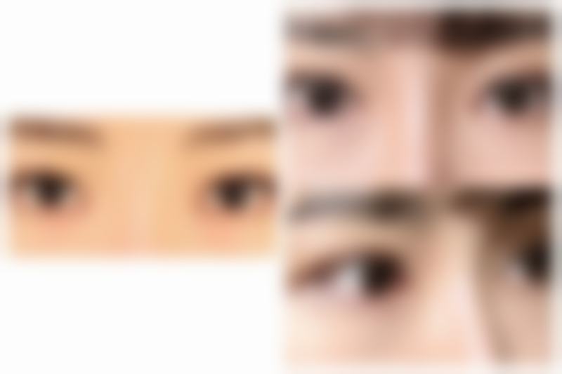 三、怎么去除烧伤后的疤痕之药物治疗